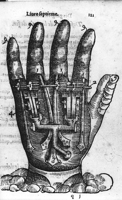 A sketch of 16th a century arm stretcher, an early bone setting