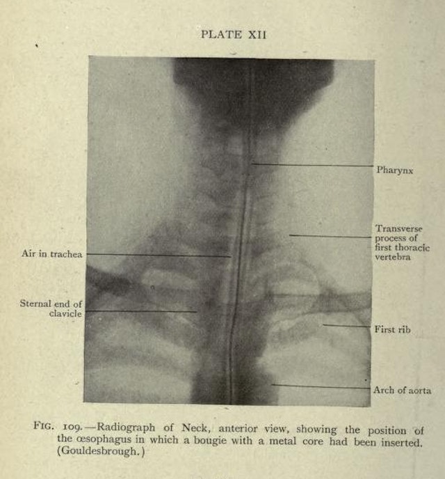 Anatomically labelled X-Ray images (1920)