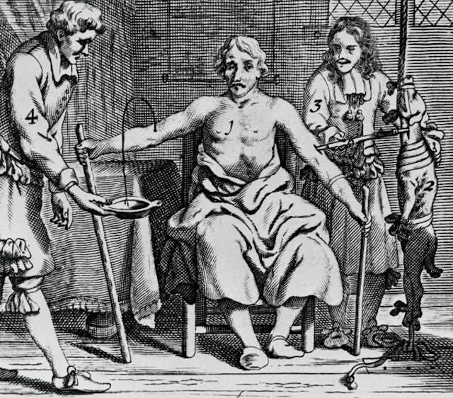 Arthur Coga’s Blood Transfusion (1667)