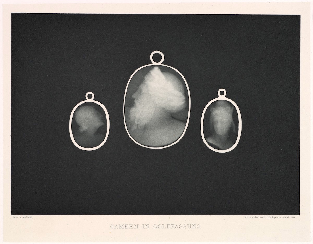 human exposure x ray 1890s