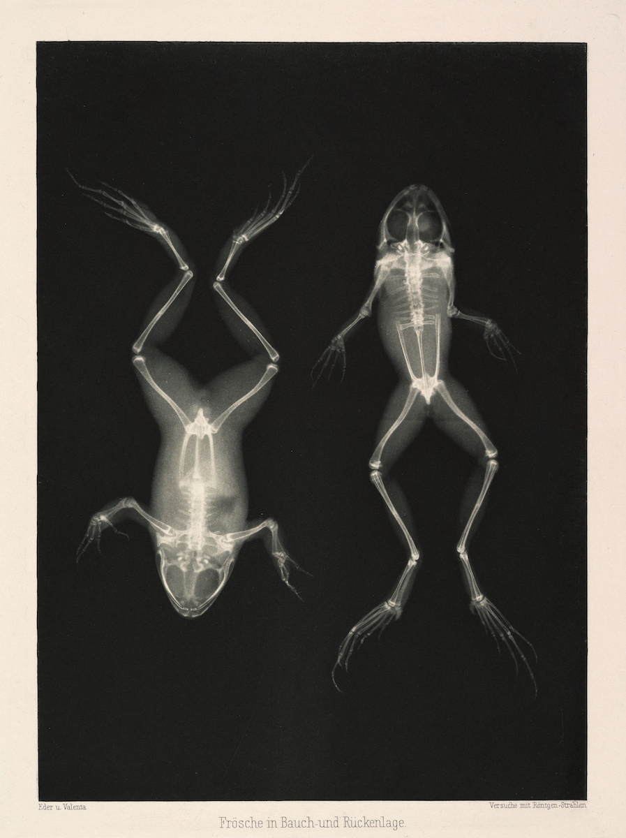 Early Experiments with X-Rays (1896) — The Public Domain Review