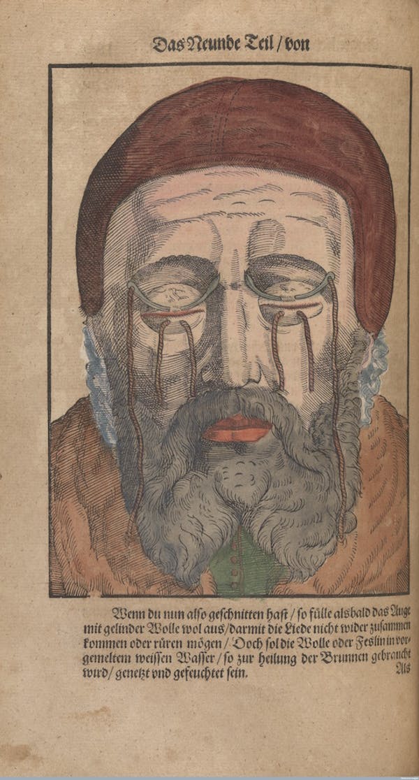 L0078611 Folio 186 verso, Bartisch, Ophthalmodouleia, 1583.