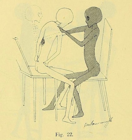 Gynecological Gymnastics from Outer Space (1895)  20686047680_d54369a5d4_o