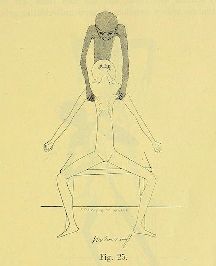 Gynecological Gymnastics from Outer Space (1895)  20847835956_9e7dce9208_o