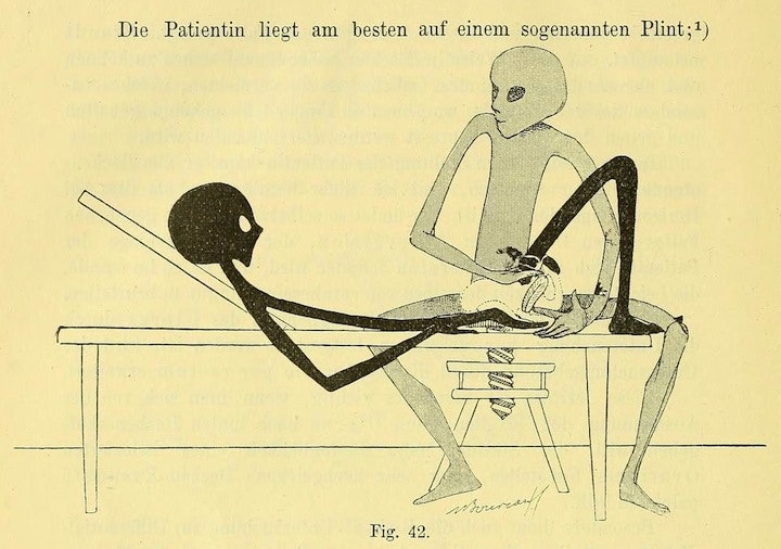 Gynecological Gymnastics from Outer Space (1895)  20881324291_a08debb46f_o