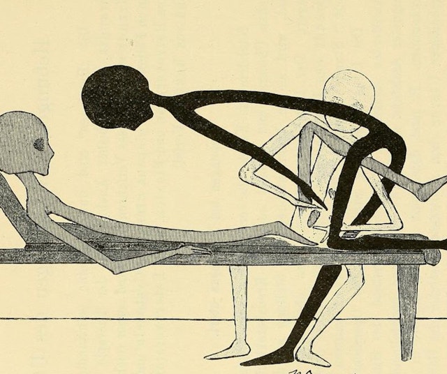 Gynecological Gymnastics from Outer Space (1895)