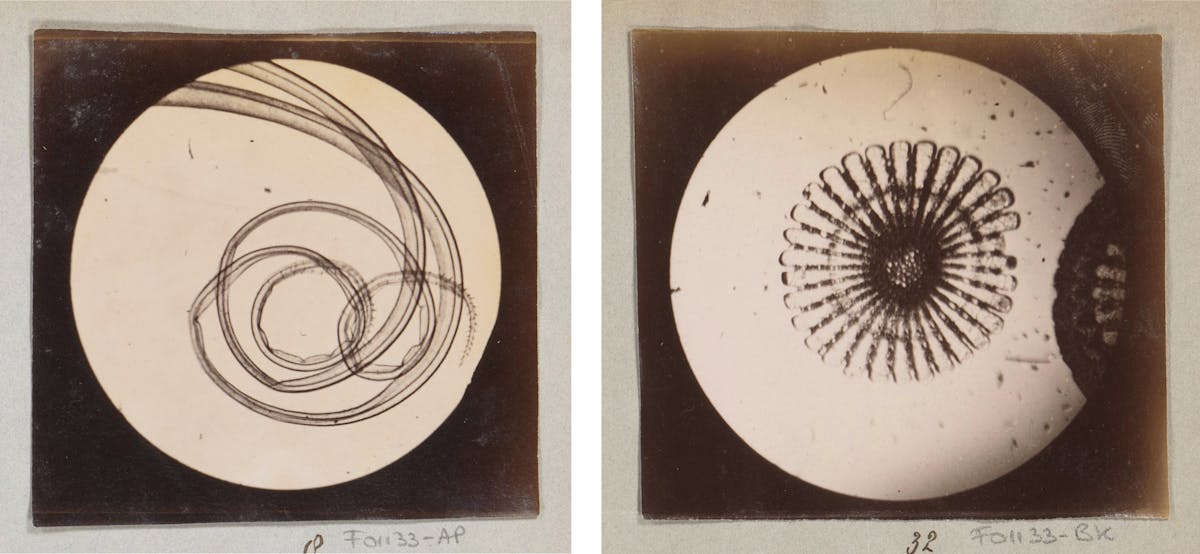 Micrograph spread