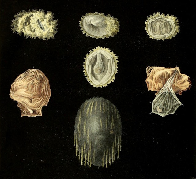 Joseph Perry’s Medical Illustrations of Miscarriage (1834)