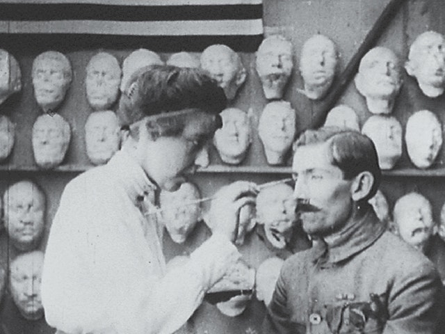 Plastic Reconstruction of the Face (1918)