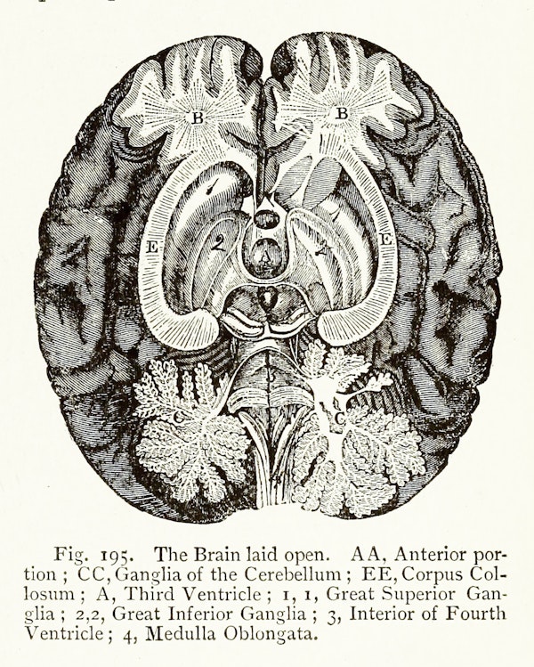 Illustration related to chromotherapy