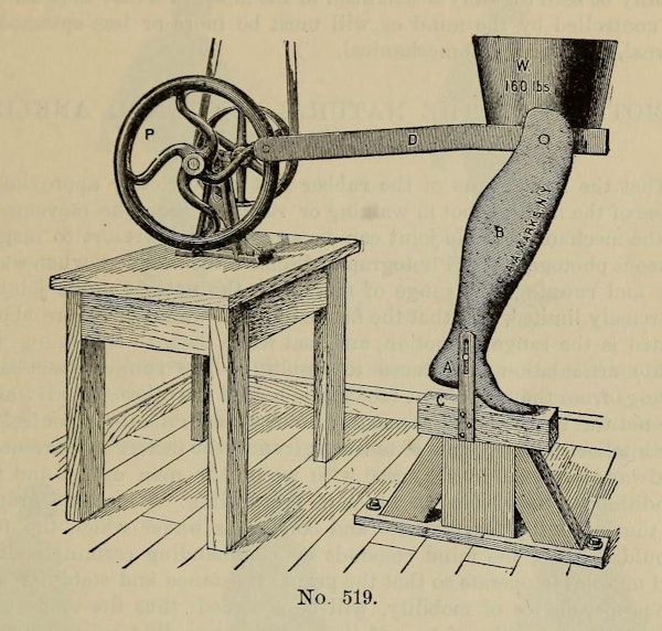 Illustration from a treatise on artificial limbs