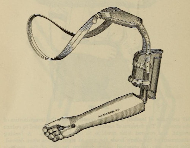 *A Treatise on Artificial Limbs* (1899)