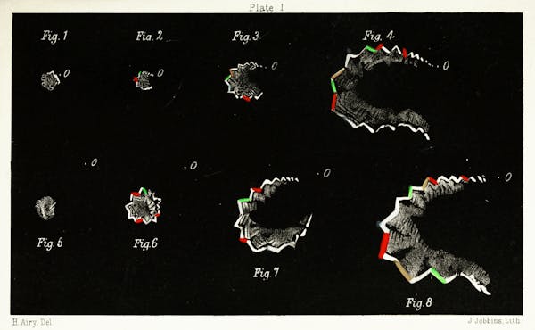 migraine visualization