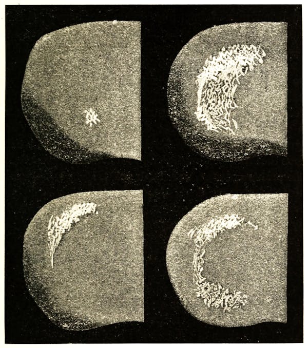 migraine visualization