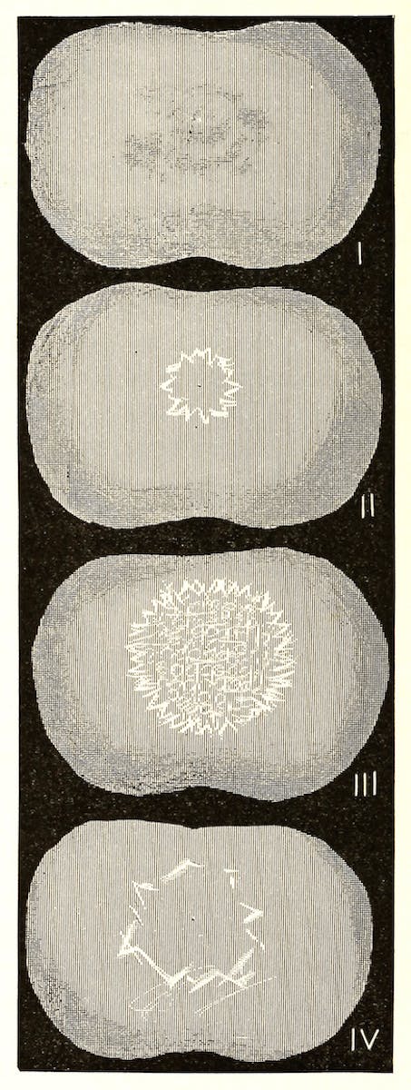 migraine visualization