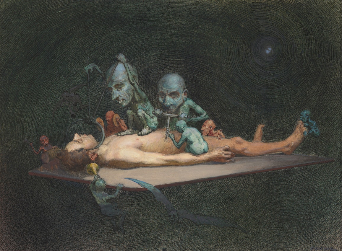 A man lying on an operating table with demon-like creatures on his chest