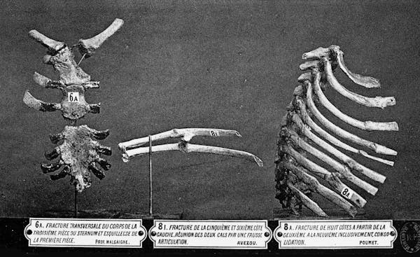 Displaying the Dead: The Musée Dupuytren Catalogue