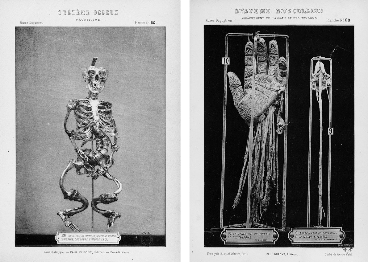 Displaying the Dead: The Musée Dupuytren Catalogue — The Public