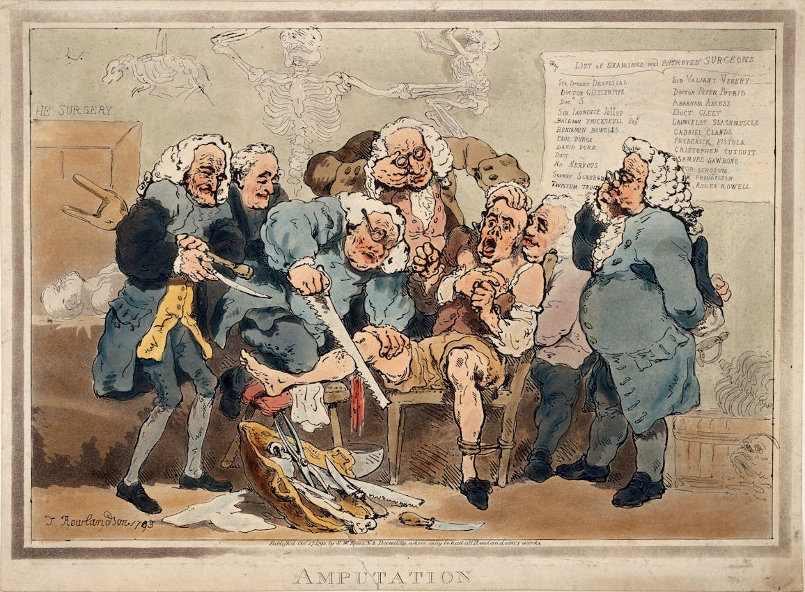 amputation by Thomas Rowlandson