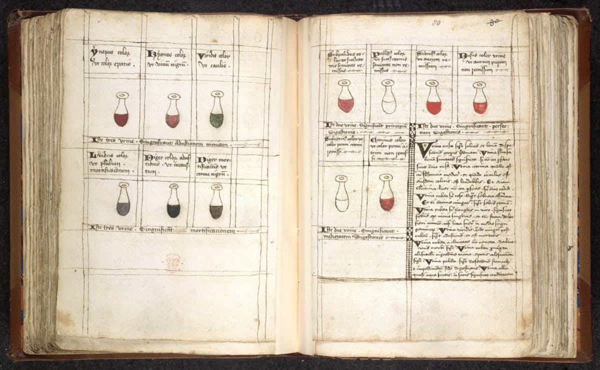 Urine flasks of various colours connected by lines to explanatory text