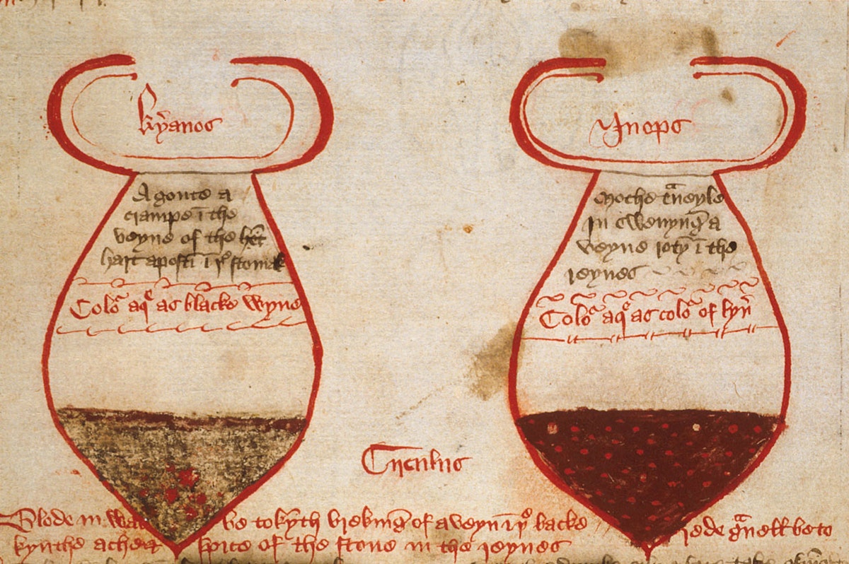 Two urine flasks with layers and sediment